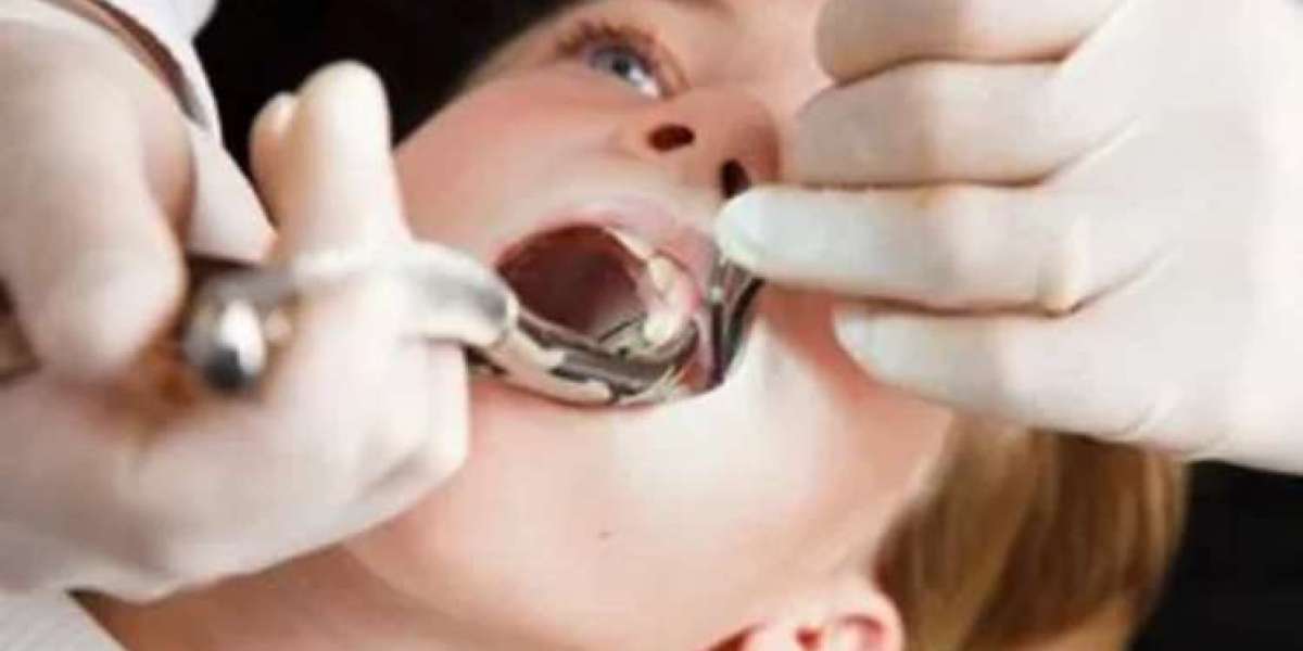 New York Tooth Extraction