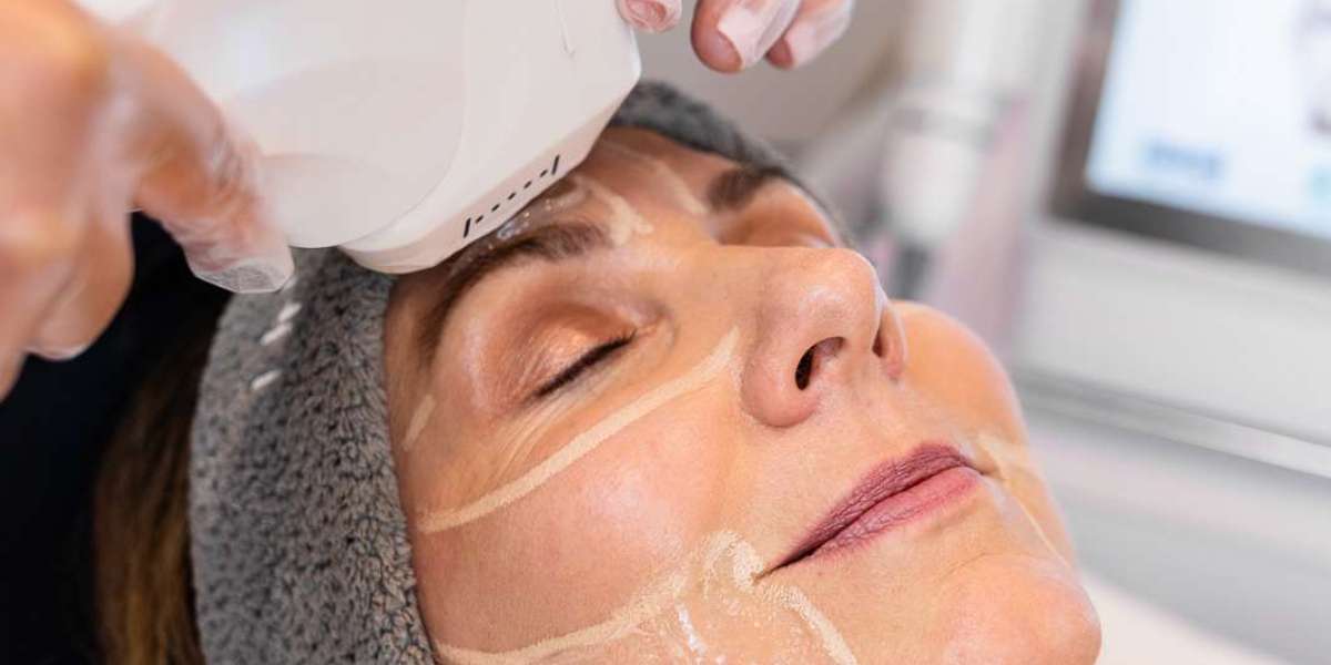 How Does Ultherapy Differ from Other Skin Tightening Procedures?