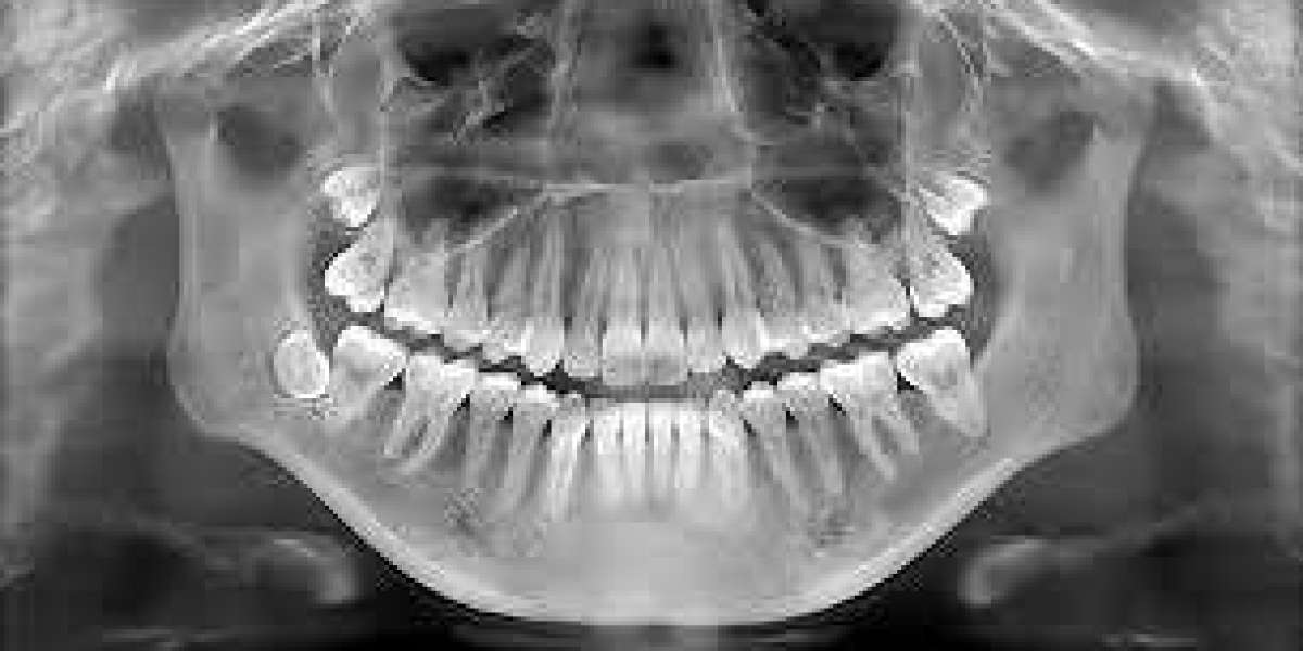 Cost-Effective Solutions for Panoramic Dental X-Rays in Dubai